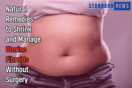 Natural Remedies to Shrink and Manage Uterine Fibroids Without Surgery