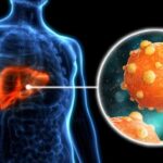 How to Detect Hepatitis B in Its Early Stages: Symptoms, Tests, What to Do Next