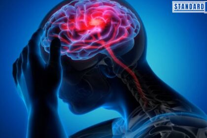 How to Prevent Stroke: Simple Daily Habits That Work